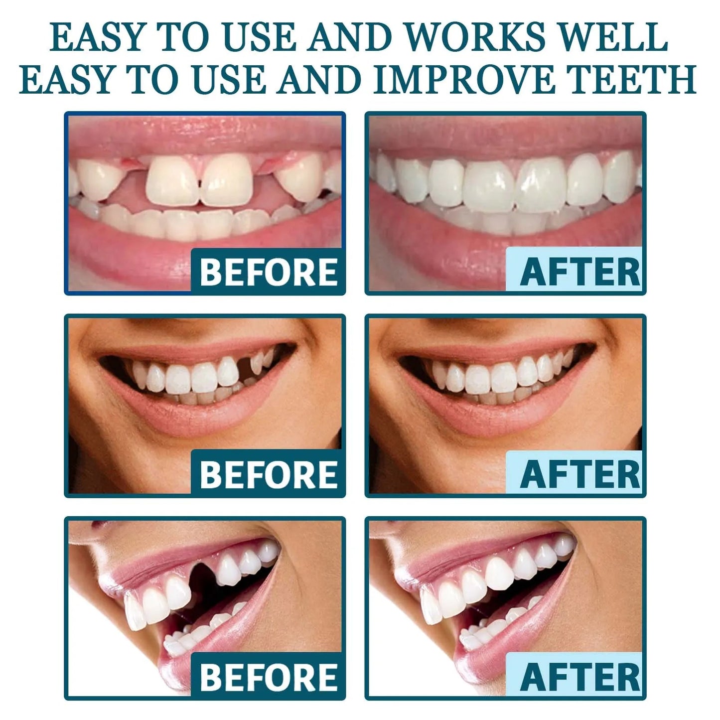 New Adult Adjustable Dentures Teeth Set Adjustable Snap-on Fake Teeth Portable Braces Decorate Gaps For Teeth Enhance Aesthetic WAREHOUSE SHOP