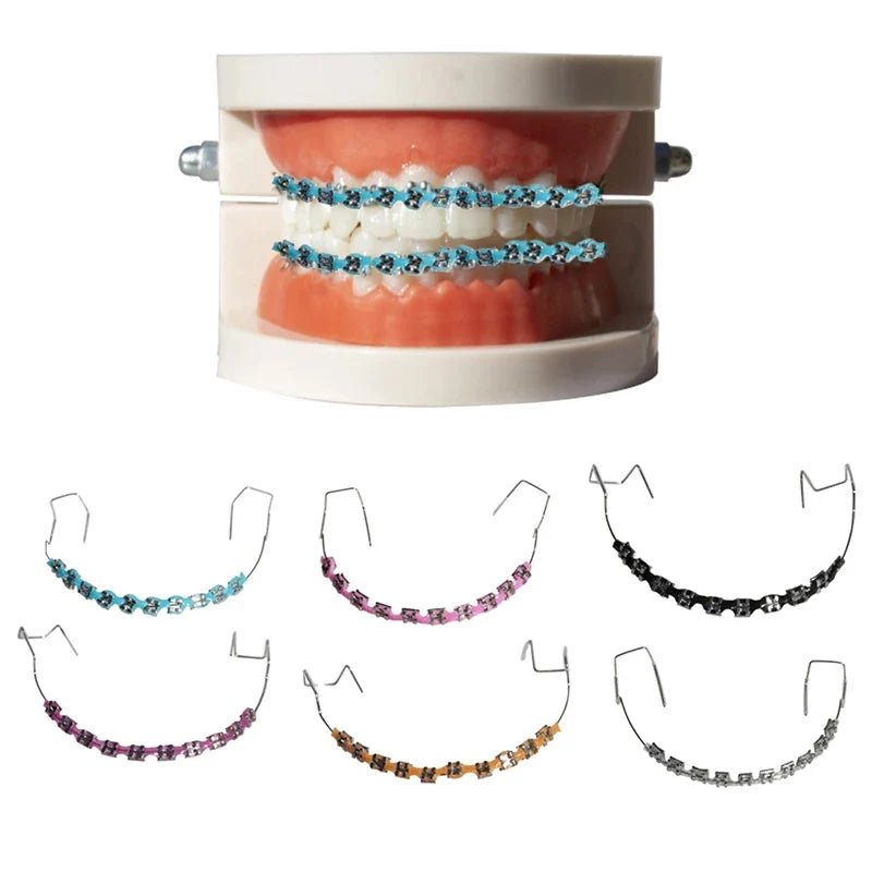 Clip - On Teeth Braces with Metal Wires & Ligature Ties – Temporary Dental Decoration - WAREHOUSE SHOP