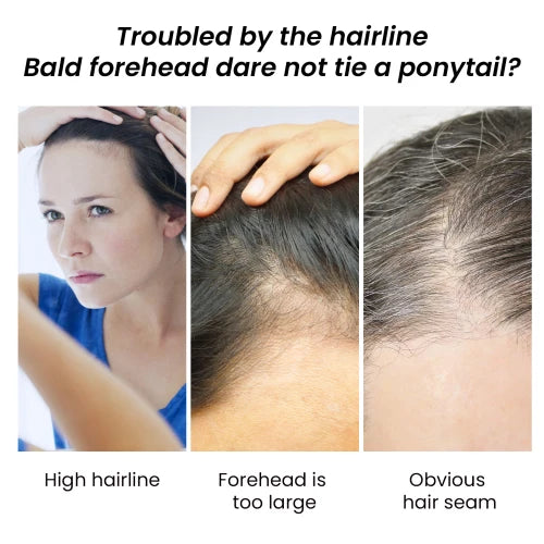 EELHOE Covering Touch Mild Refreshing Oil Control Easy To Apply Concealer Powder For Hairline