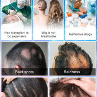 Hair Growth Serum - Awakens Dormant Follicles for Thicker Fuller Hair