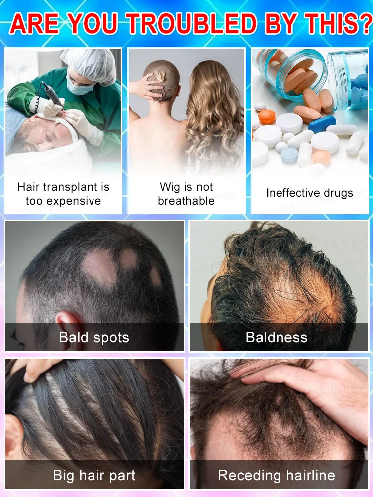 Hair Growth Serum - Awakens Dormant Follicles for Thicker Fuller Hair