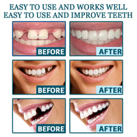 New Adult Adjustable Dentures Teeth Set Adjustable Snap-on Fake Teeth Portable Braces Decorate Gaps For Teeth Enhance Aesthetic WAREHOUSE SHOP