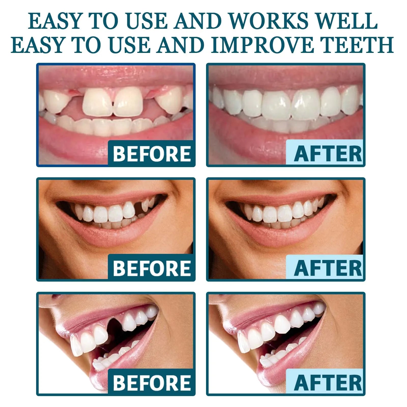 New Adult Adjustable Dentures Teeth Set Adjustable Snap-on Fake Teeth Portable Braces Decorate Gaps For Teeth Enhance Aesthetic WAREHOUSE SHOP