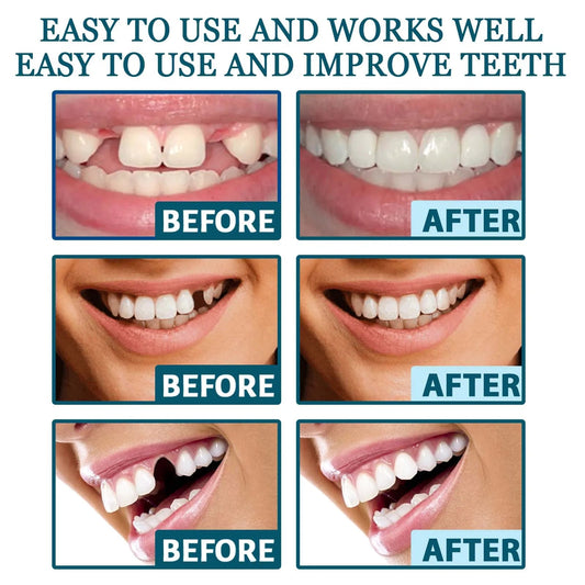 New Adult Adjustable Dentures Teeth Set Adjustable Snap-on Fake Teeth Portable Braces Decorate Gaps For Teeth Enhance Aesthetic WAREHOUSE SHOP