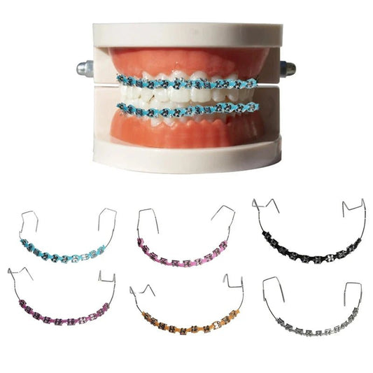 Clip - On Teeth Braces with Metal Wires & Ligature Ties – Temporary Dental Decoration - WAREHOUSE SHOP