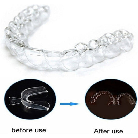 Teeth whitening & night guard trays for dental care & grinding prevention Braces. - WAREHOUSE SHOP